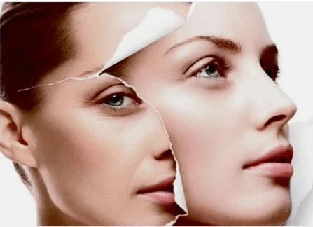Procedimiento de rejuvenecimiento con láser facial para las contraindicaciones