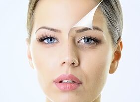 Cómo rejuvenecer la piel alrededor de los ojos en casa.